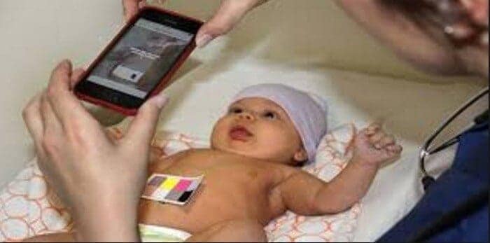 akıllı telefon ile sarılık testi akıllı telefon ile sarılık testi