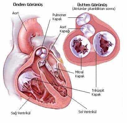 mitral kalp kapakçığı tedavisi