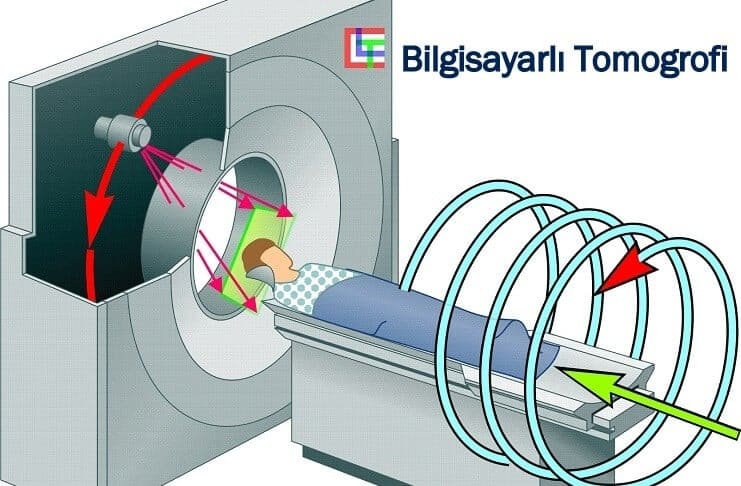 bilgisayarli-tomografi