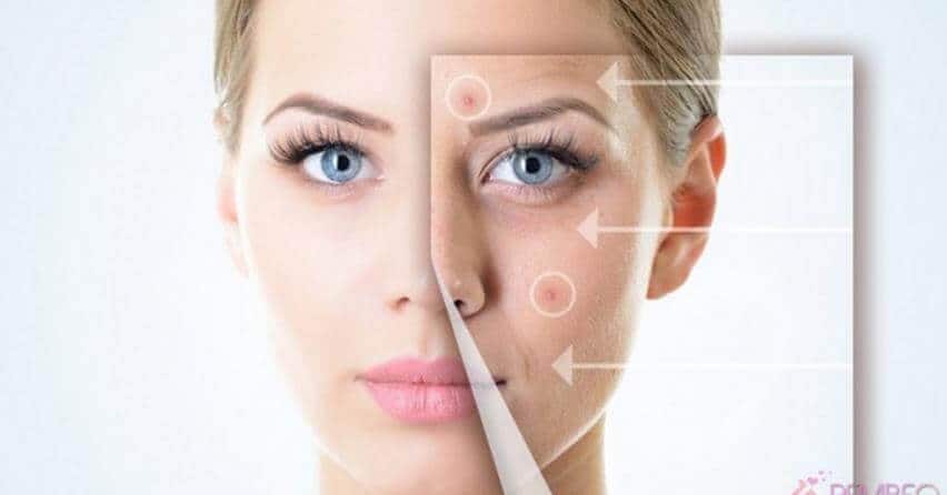 Hyaluronik Asit Nedir Hyaluronik Asit Nedir