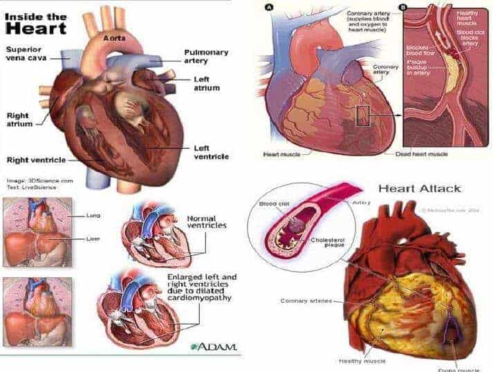 kalp hastalıkları