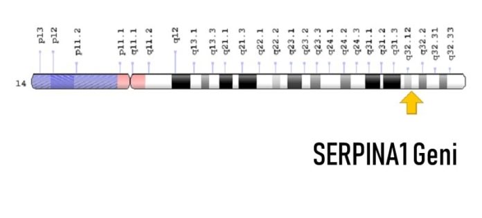 SERPINA1 Geni